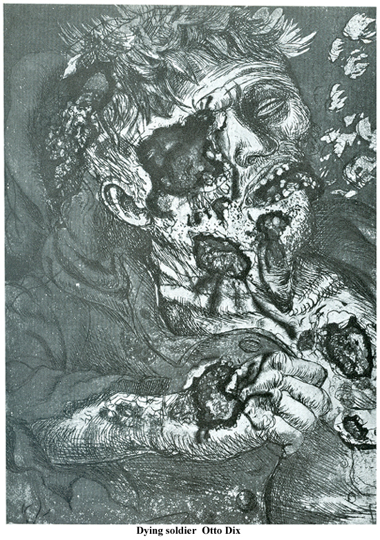 Dying soldier Otto Dix 26